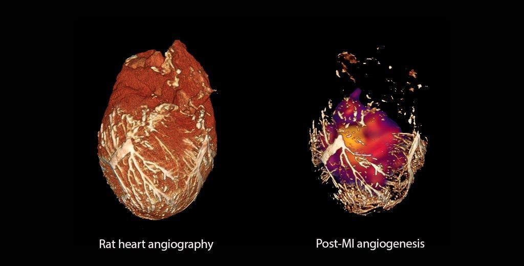 Rat heart angiography and post-MI angiogenesis