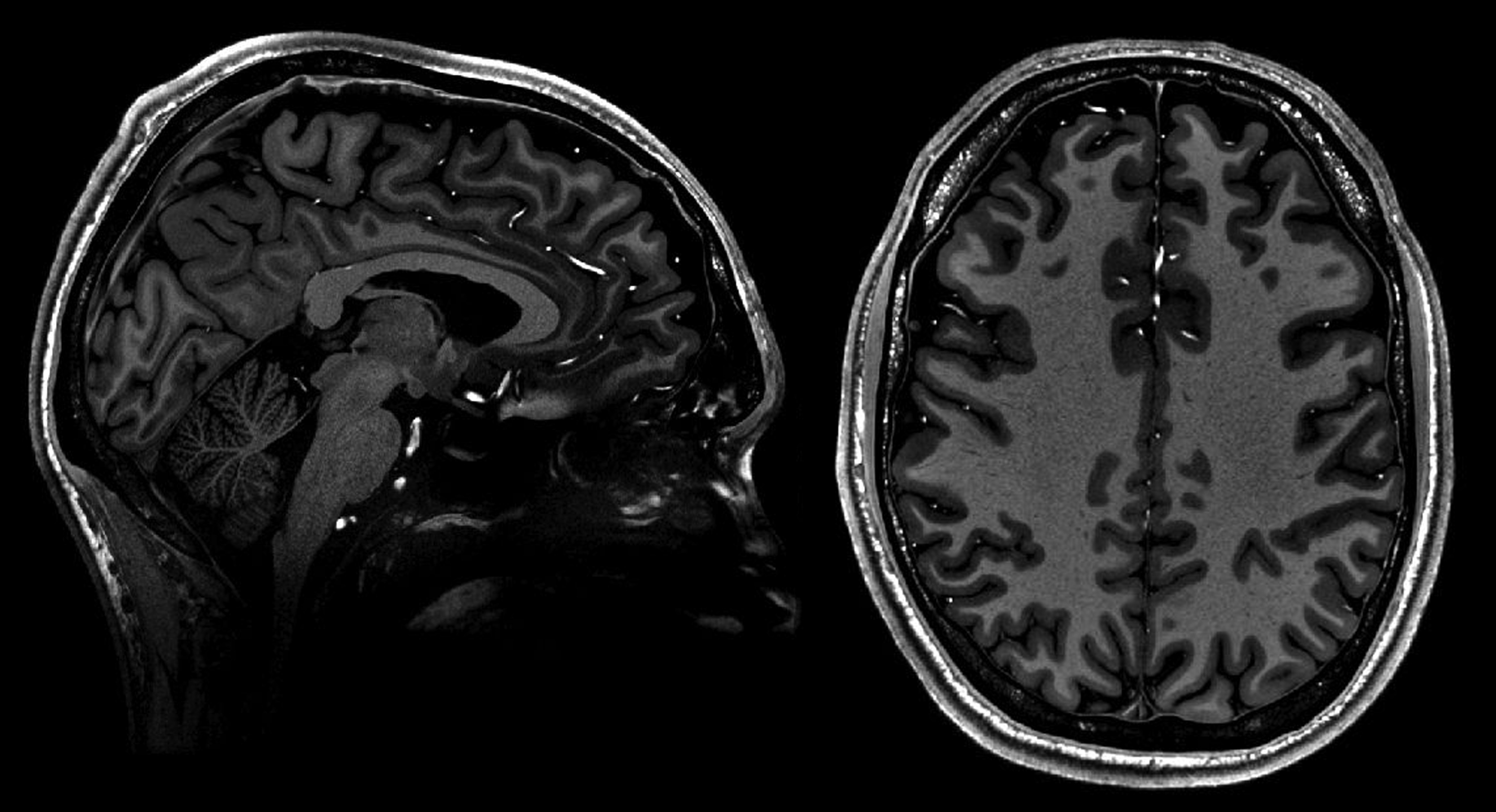 7T axial and sagittal brain scans